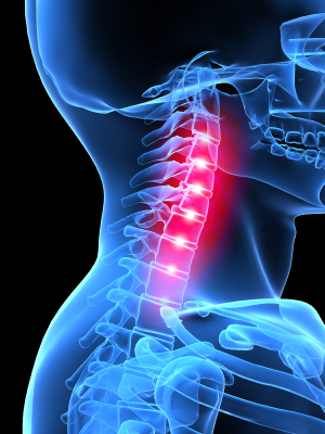 Steroid medication for lower back pain
