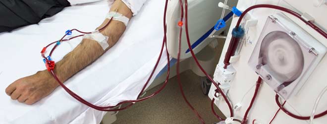 man having kidney dialysis due to kidney failure