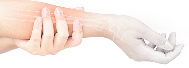 A womans arm in pain after an arm injury seeking social security disability.