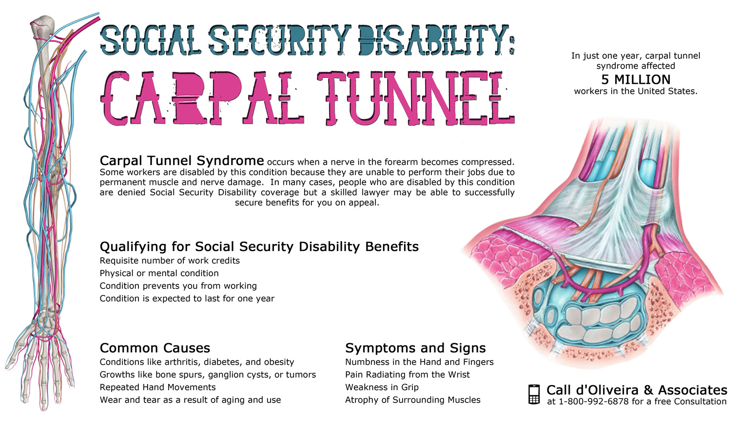 Social Security Disability with Carpal Tunnel Syndrome Infographic