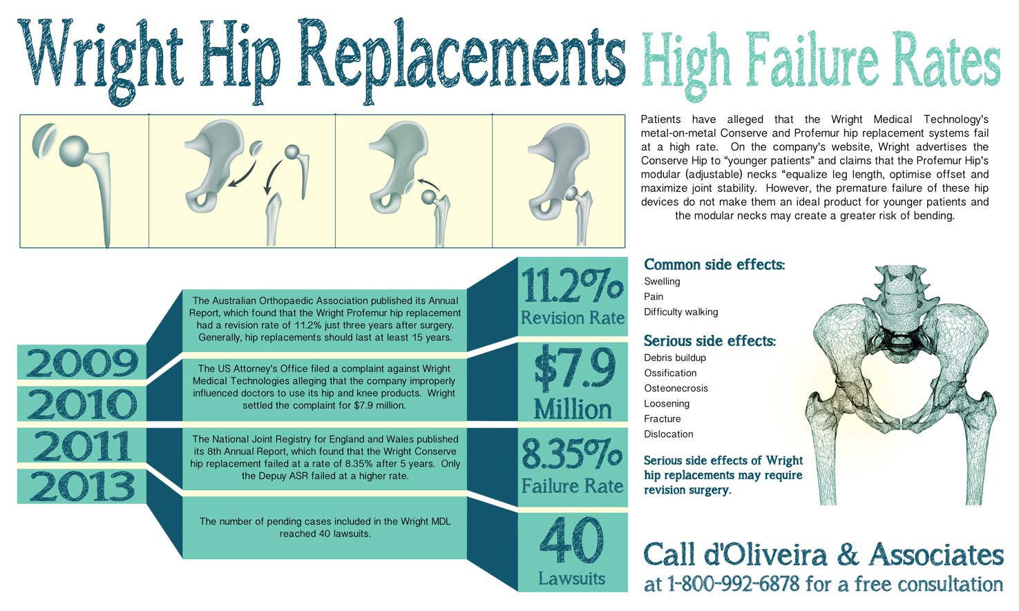 Wright Hip Lawyer Side Effects Infographic