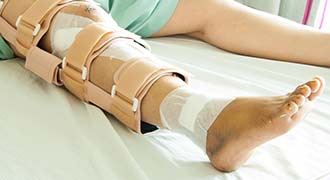 leg of injured employee on workers' compensation