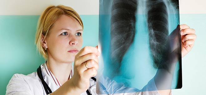 Doctor reviewing x-ray of patient who may have lung cancer