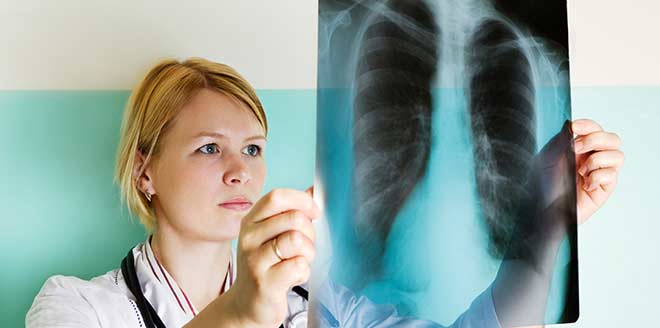 A doctor examining an X-Ray after a rhode island emergency room mistakes lawyer filed a lawsuit.