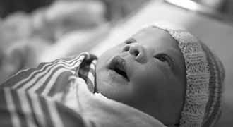 A newborn with cerebral palsey