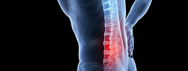 injured person needing a Back Injury Attorney