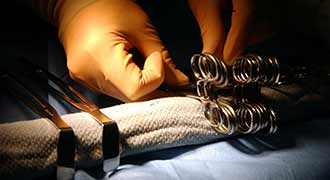 A doctor using surgical clamps.