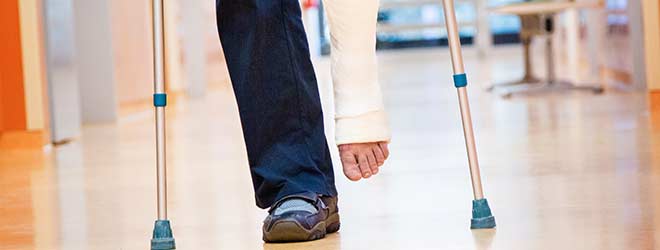 A man's leg in a cast after a slip and fall accident at a commercial property