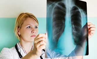 chest x-ray showing of asbestos exposure
