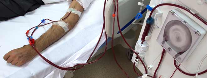 A person is receiving dialysis.