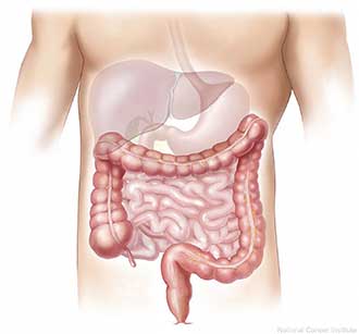 Diagram of a patient with stomach intestine and liver problems.
