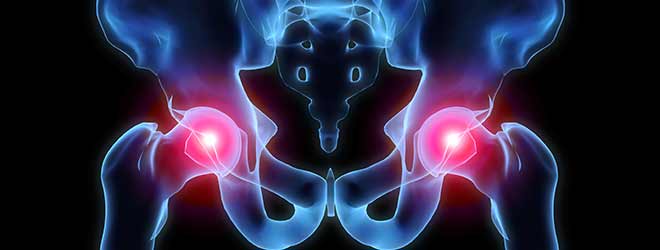 Hip Injuries