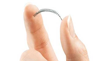 woman holding an Essure birth control device