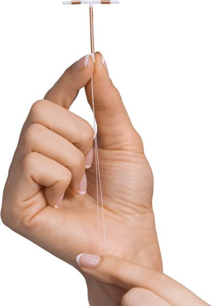 Contraceptive Device Recall on the Paragard IUD. Direct compensation may be awarded to anybody who has had the Paragard procedure done.
