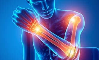 arm injury 3D