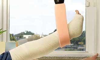 A leg in a cast is being elevated in the air with a sling.
