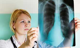 woman looking at chest x-ray 