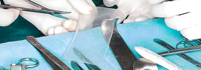 Surgeons preparing a hernia mesh patch for surgery.