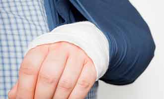 A man's arm in a cast and sling.