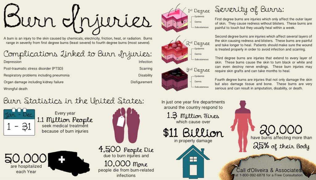 burn injury lawyer infographic