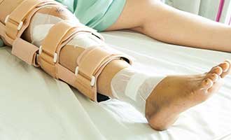 A leg bandaged and in a cast. 