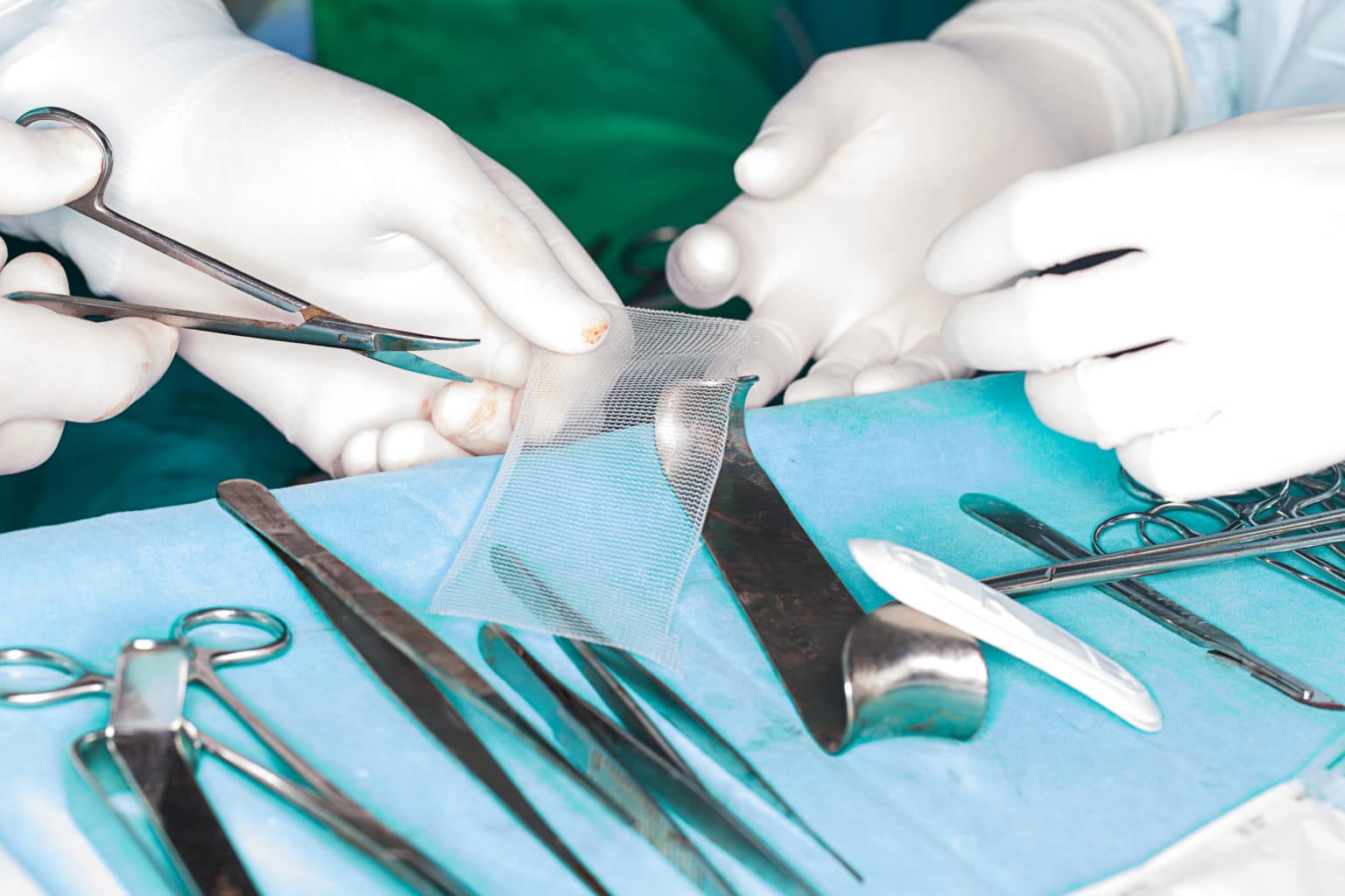 doctors perform surgery using hernia mesh patch