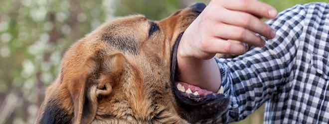 Dog biting man's arm