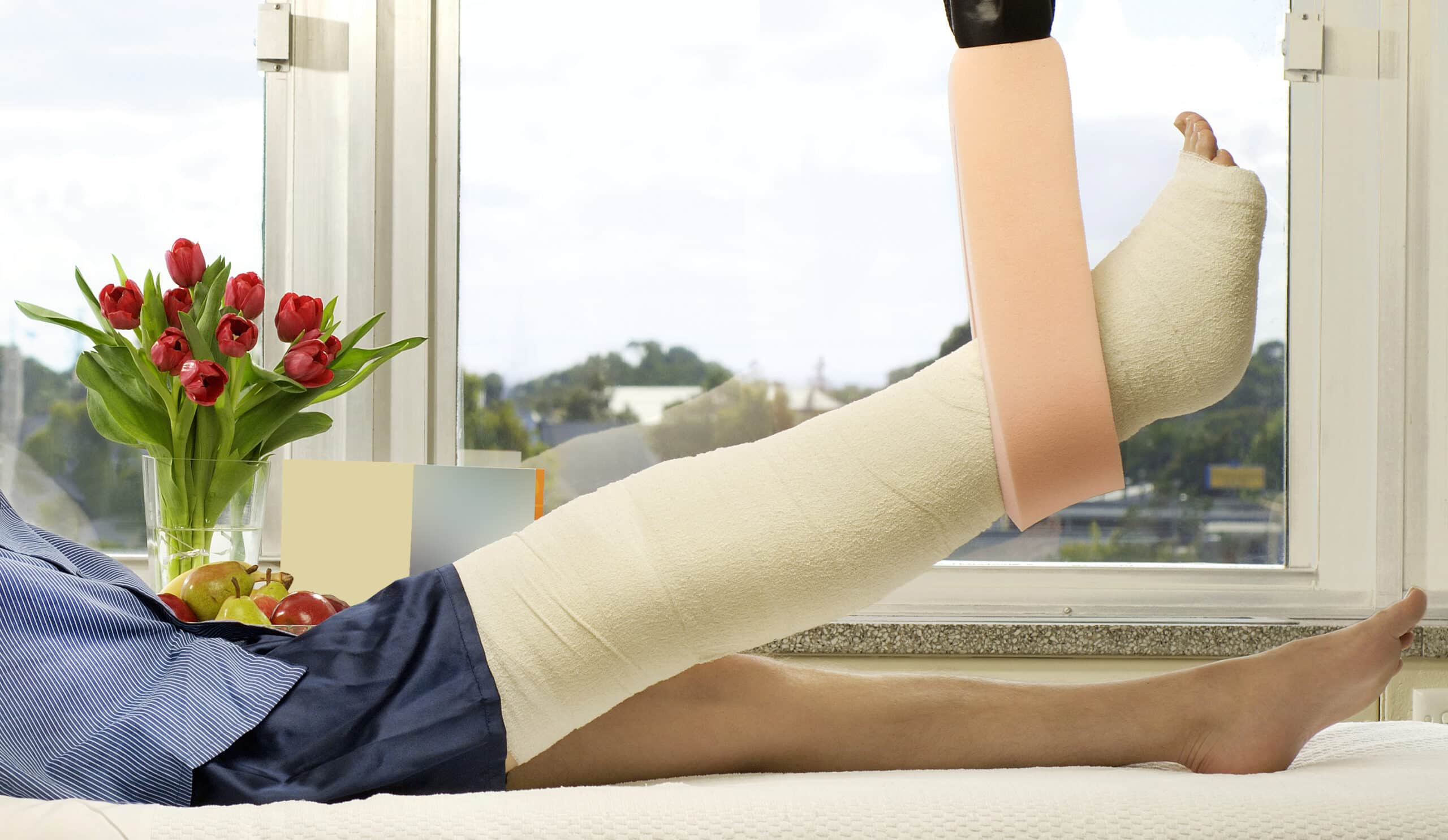 A patients leg in a cast and sling.