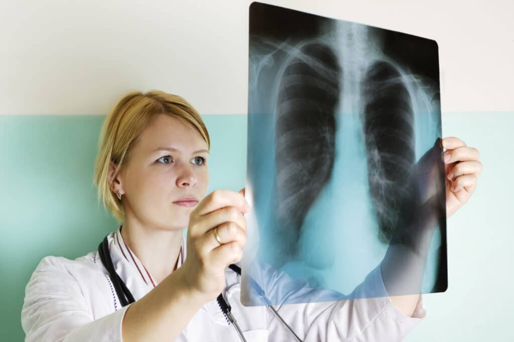 A doctor reviewing x-rays of a chest. 