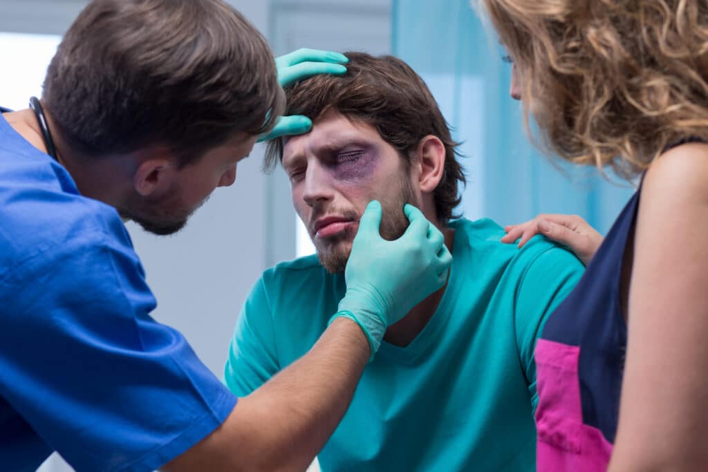 Man with bruised eye after an auto accident